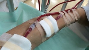 人工透析-血液透析導入-穿刺