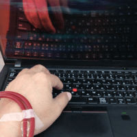 本日の透析が始まりました。